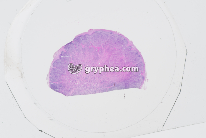 Ganglion lymphatique x1,5 - gryphea.org